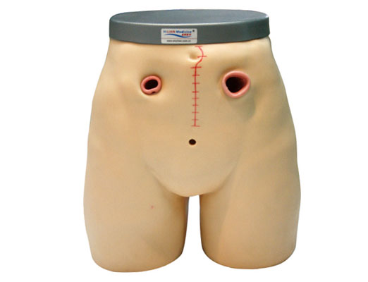 瘺管造口術(shù)護(hù)理模型
