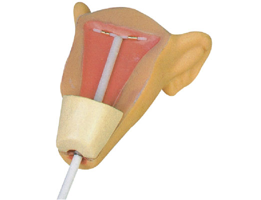 宮內(nèi)避孕器訓(xùn)練模型