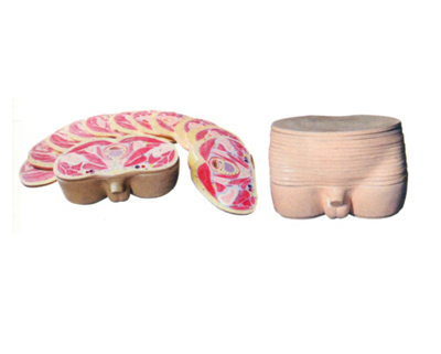 男性盆部橫斷斷層解剖模型