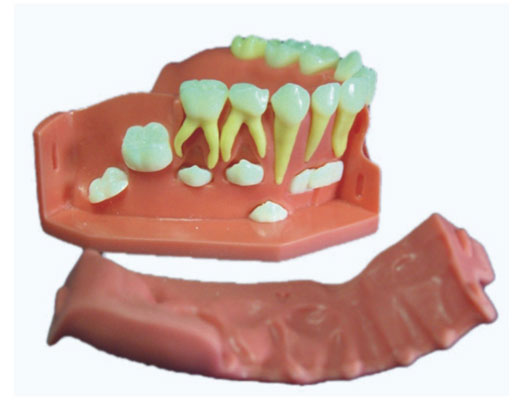 牙列發(fā)育模型