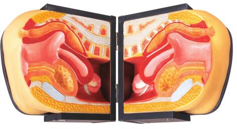 女性避孕器指導(dǎo)模型